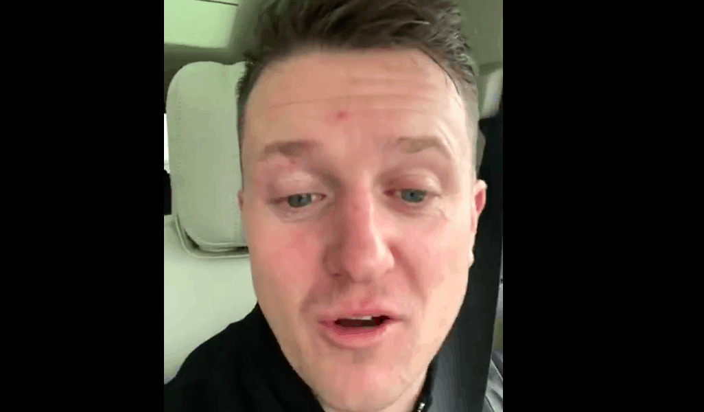 Jewish Racial Operative Tommy Robinson Calls White Nationalists ‘Inbreds’ & Laughs At White Replacement